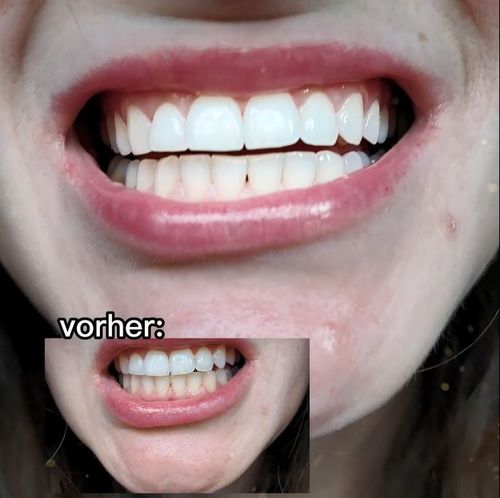 Gut für Fotos und Alltag