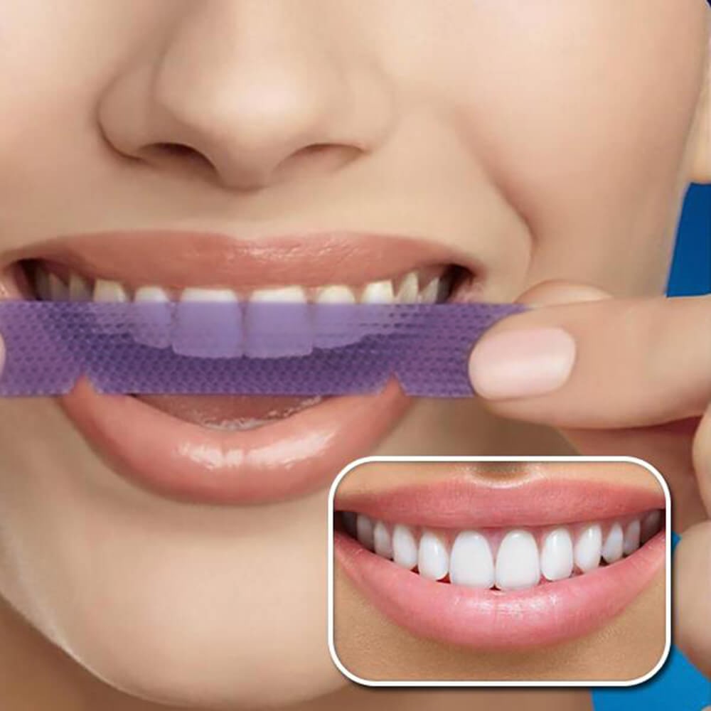 diamondsmile-zahnbleaching-white-strips-flexible-strips-f-r-zu-hause image 5