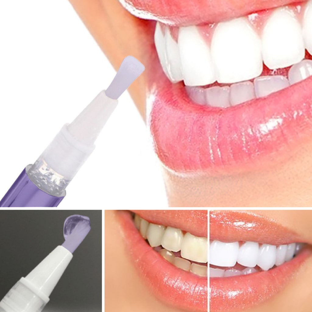 diamondsmile-farbkorrektur-zahnbleaching-stift-violett image 5