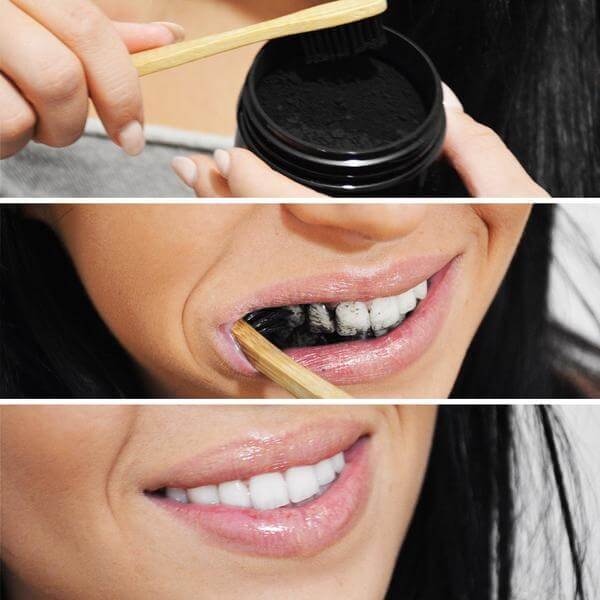 diamondsmile-zahnbleaching-aktivkohle-nat-rliches-putzpulver-gegen-verf-rbungen image 5