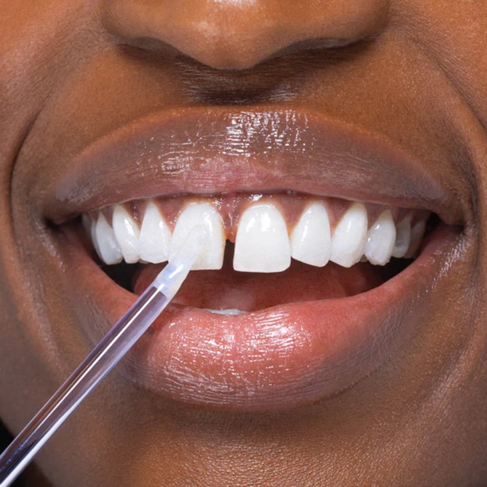 diamondsmile-bleaching-glow-stick-sofort-zahngloss-zur-kosmetischen-zahnaufhellu image 4